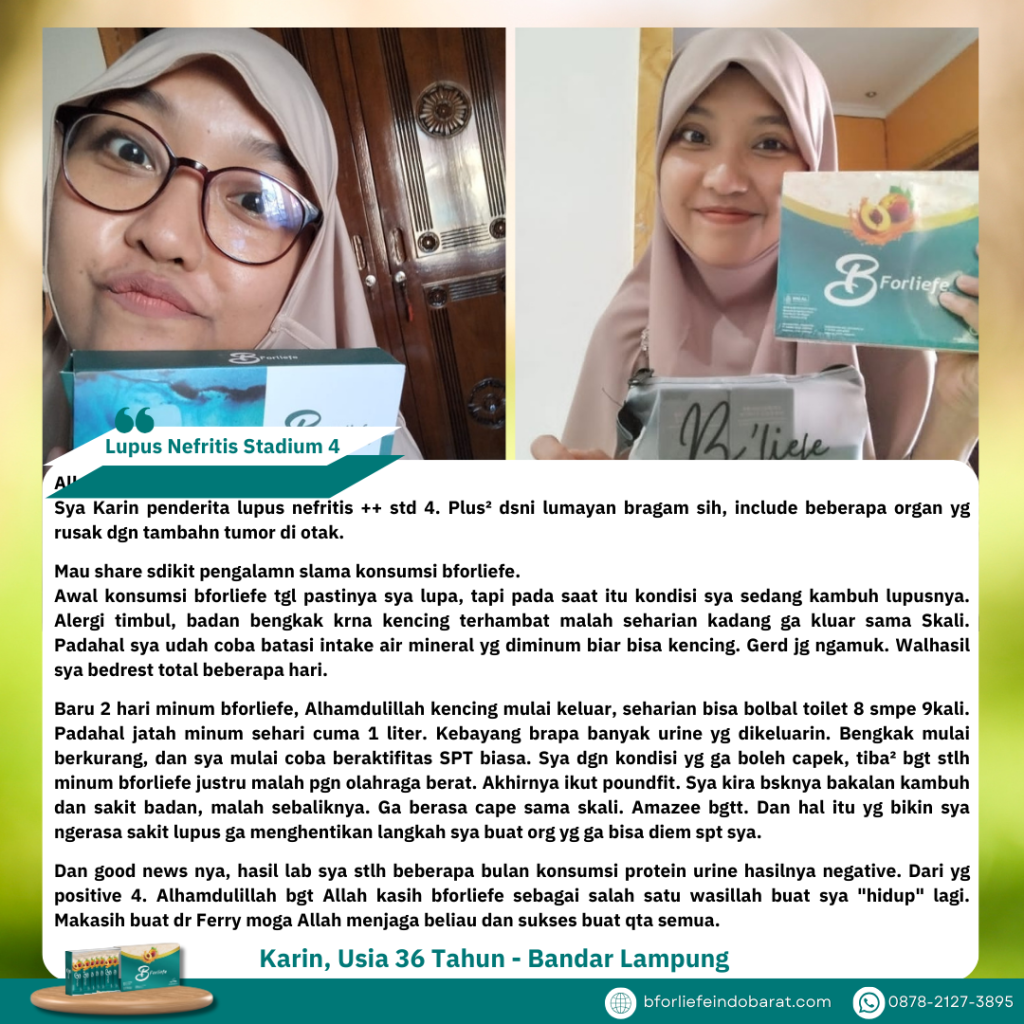 LUPUS NEFRITIS ST. 4